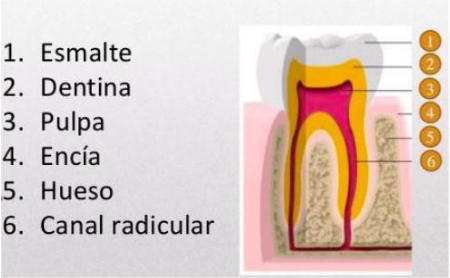 Caries Dental en Espacio Dental Jaén