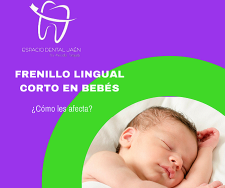 Frenillo lingual corto en bebés - Espacio Dental Jaén