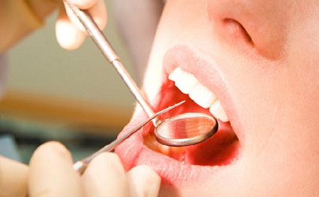 Encías inflamadas. Causas y tratamientos - Espacio Dental Jaén
