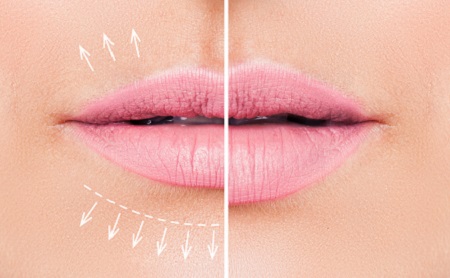 Cómo mejorar tus labios - Espacio Dental Jaén