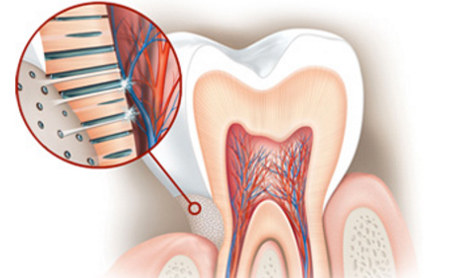 Dientes sensibles Nervios - Espacio Dental Jaén