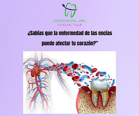 Cuidar tu sonrisa es cuidar tu corazón: la conexión entre la salud bucal y el riesgo cardiovascular - Espacio Dental Jaén