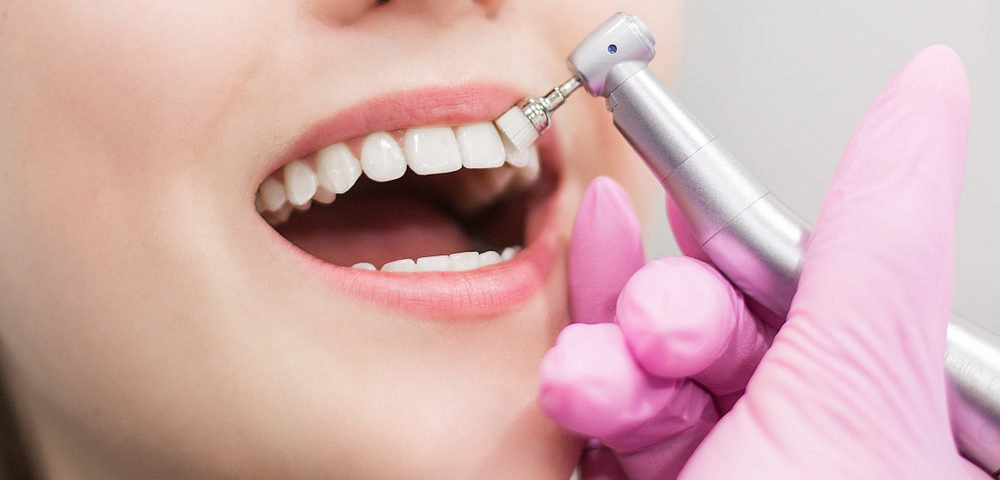 montar Nathaniel Ward Identificar Ventajas de hacerte regularmente una limpieza de boca | Espacio Dental Jaén