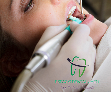 Limpieza Dental Profesional: La Clave para una Sonrisa Sana y Radiante - Espacio Dental Jaén
