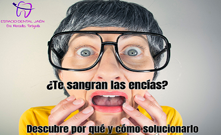 ¿Por qué me sangran las encías? Causas, riesgos y cómo solucionarlo - Espacio Dental Jaén