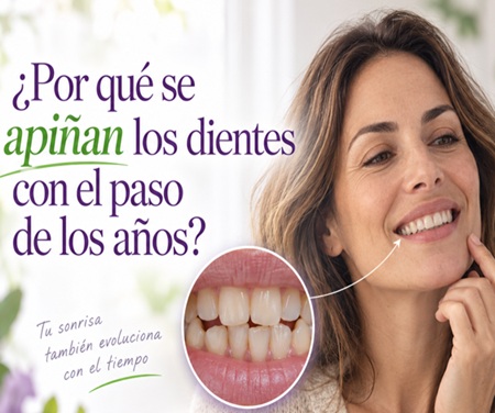 ¿Por qué se apiñan los dientes con el paso de los años? - Espacio Dental Jaén