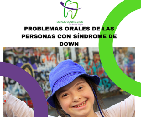 Problemas orales de las personas con Síndrome de Down - Espacio Dental Jaén