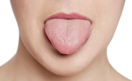 Síndrome de boca ardiente o glosodinia - Espacio Dental Jaén