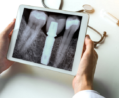 Radiografías dentales. Más allá de la sonrisa - Espacio Dental Jaén