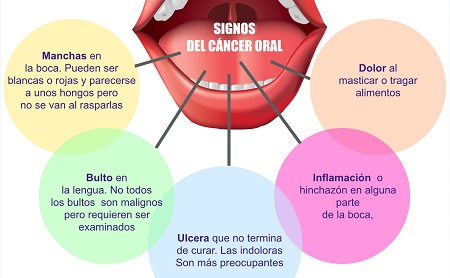 cancer bucal signos