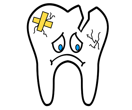 Descubriendo el Síndrome del Diente Fisurado: Más Allá del Dolor Dental - Espacio Dental Jaén