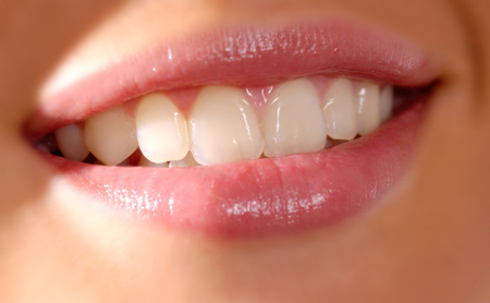 Por qué los dientes sanos cambian de color? - Color de Dientes sanos |  Espacio Dental Jaén
